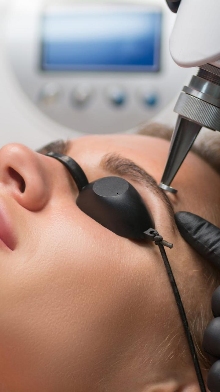 Photorejuvenation Treatment