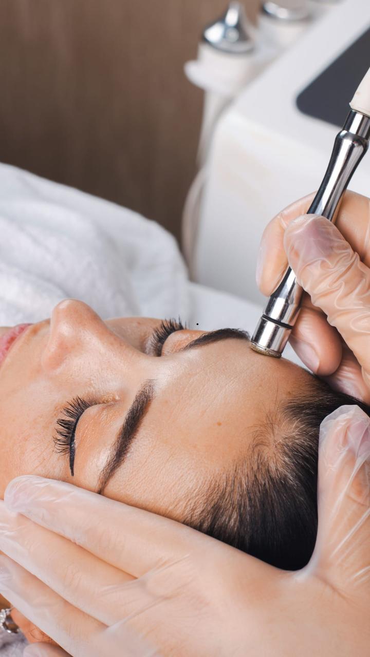 Microdermabrasion