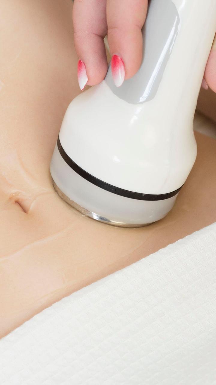 Lipocavitation Treatment