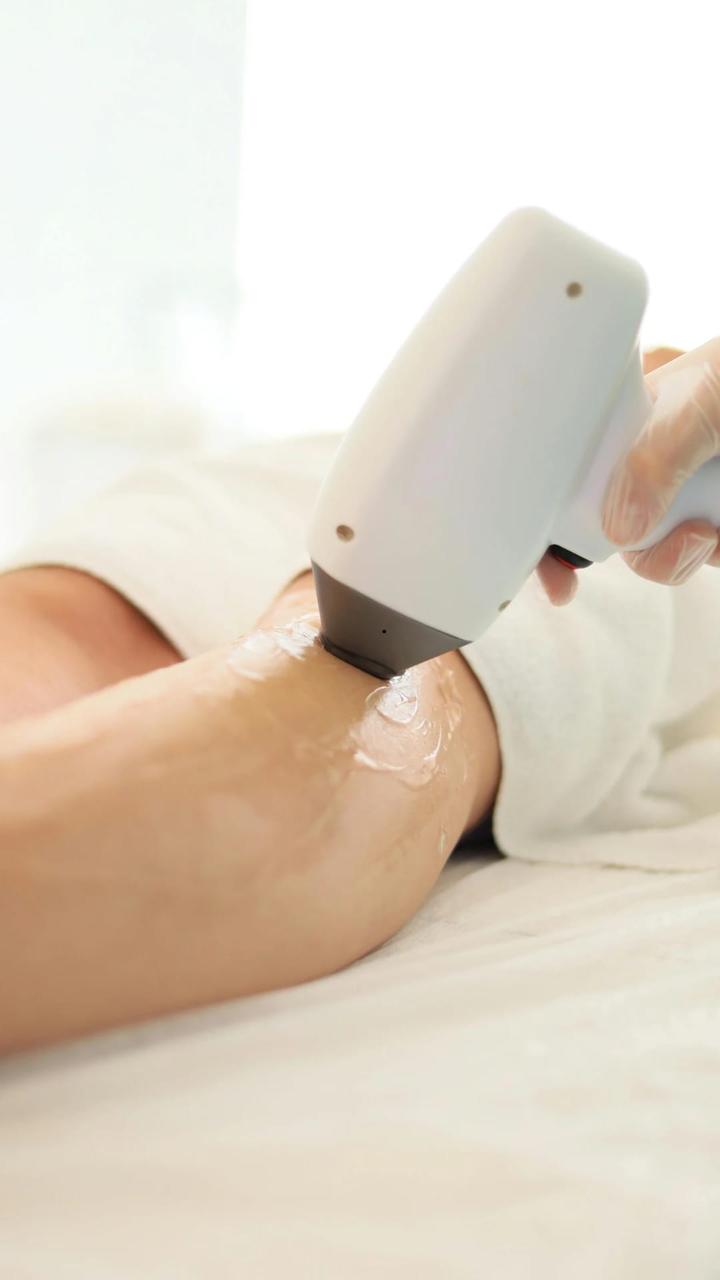 Laser Hair Removal