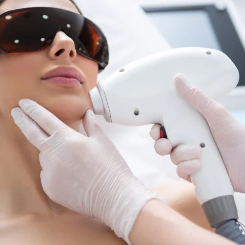 Laser Hair Removal
